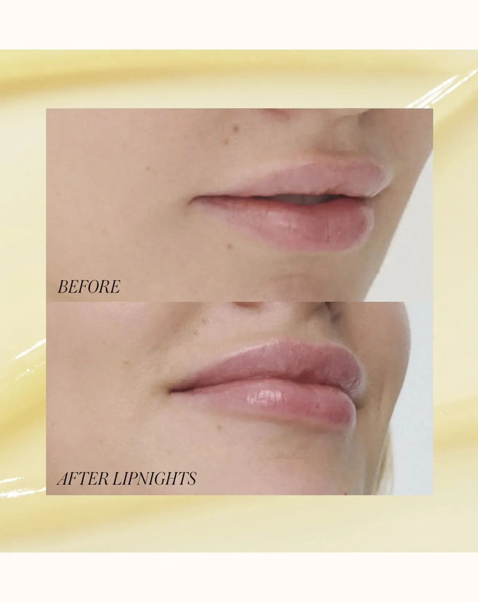 Night Mask for Lips - 9g